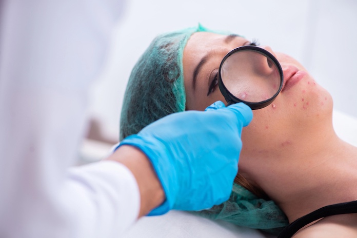 akné a návštěva lékaře